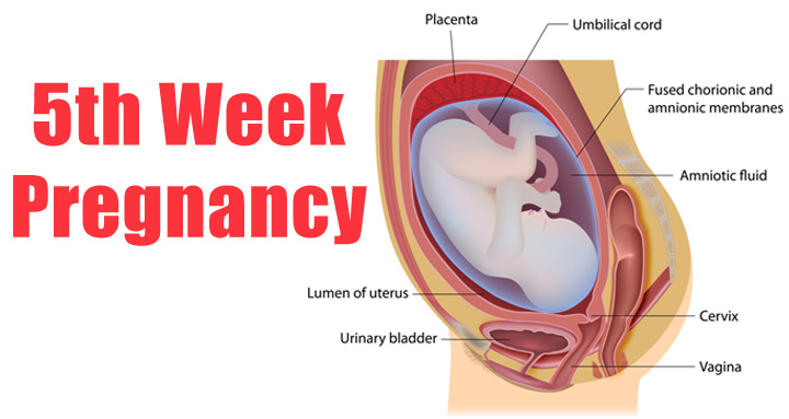 5 Weeks Pregnant - Symptoms, Baby Development, Tips And Body Changes
