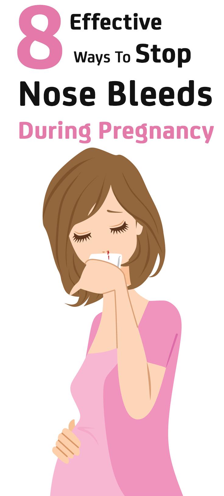 8 Effective Ways To Stop Nosebleeds During Pregnancy