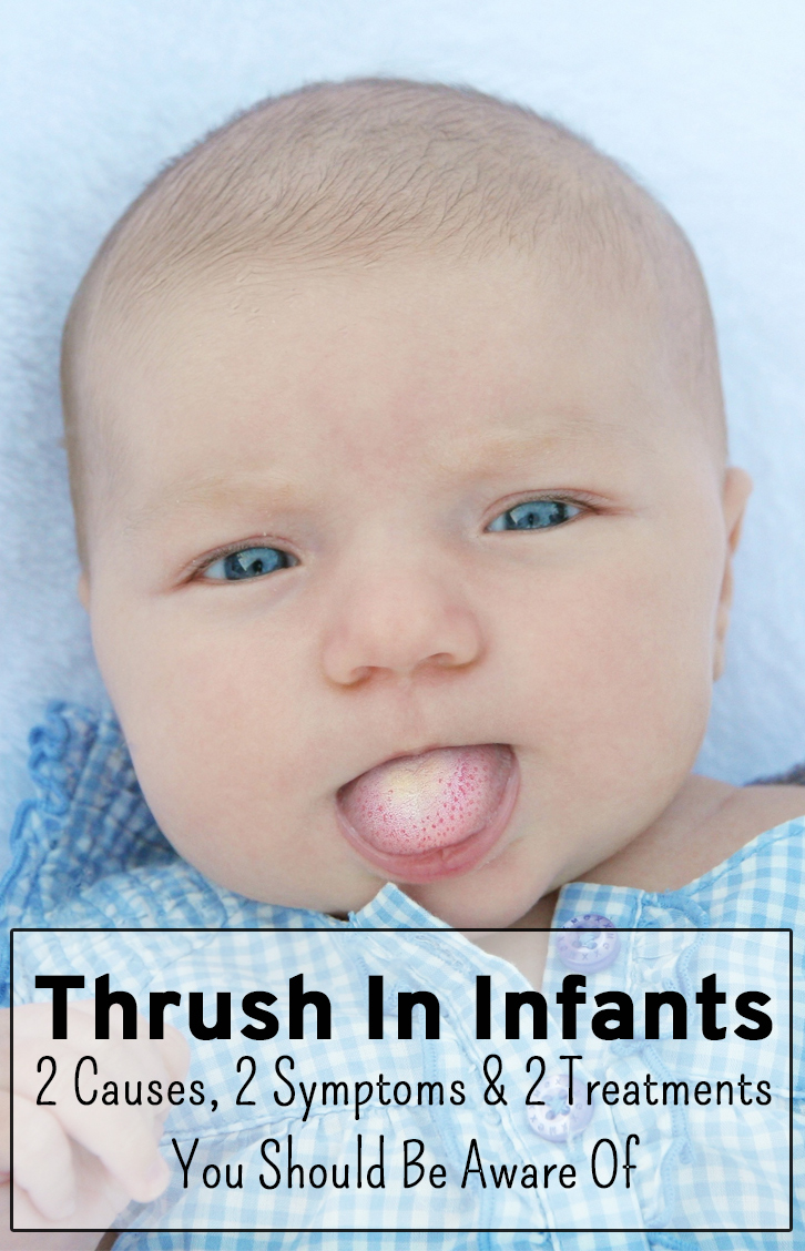 Pictures Of Thrush In Babies Mouth 13