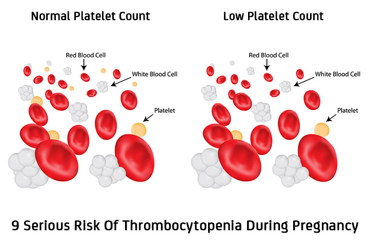 What are the symptoms of low blood platelets?