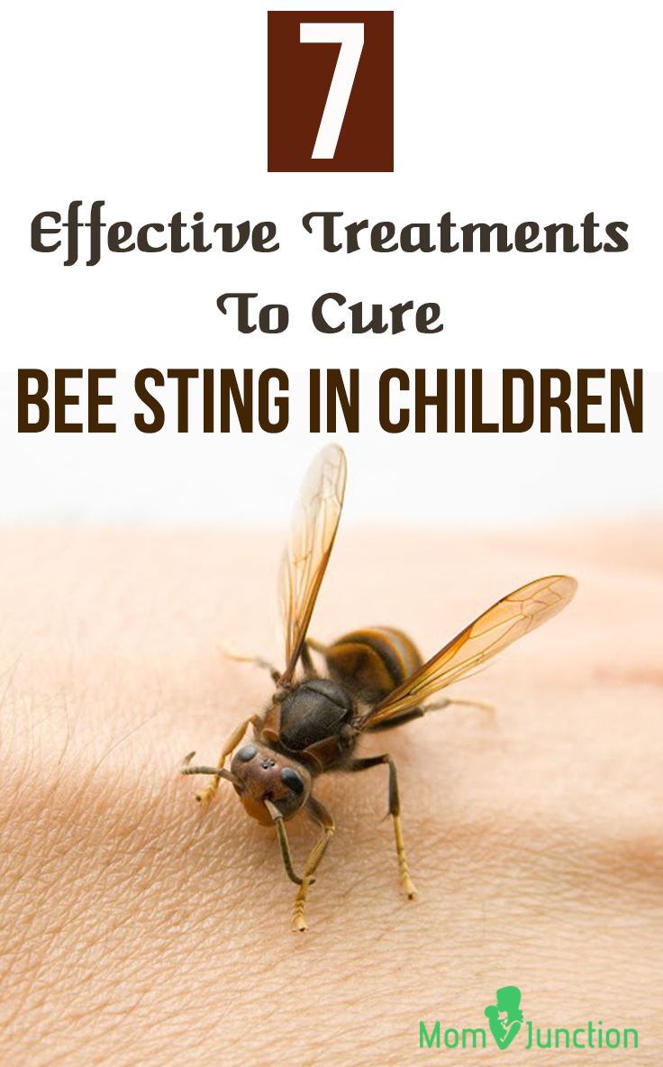 How do you treat bee stings at home?