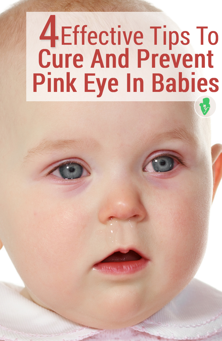 babies pink eye
