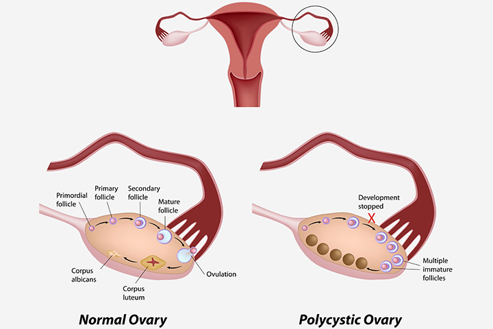 Ovaries Pregnant 46