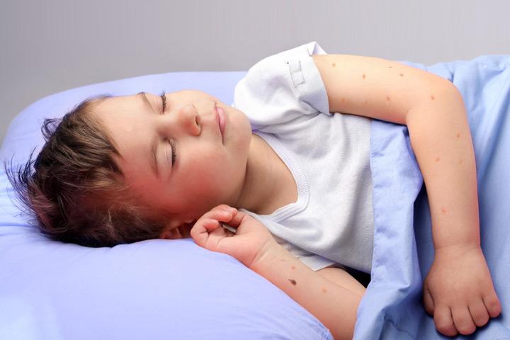 Bed Bug Bites, Rashes & Symptoms - orkin.com