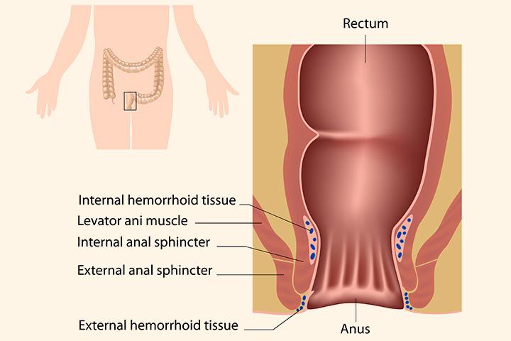 Pain inside anal hole