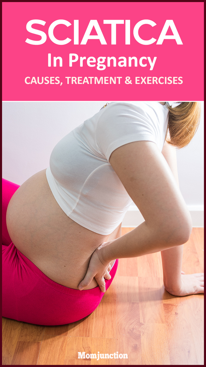 What can you do to treat sciatic nerve pain in the buttocks during pregnancy?