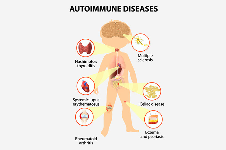 What are autoimmune diseases?