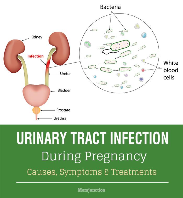 Urinary Tract Infection During Pregnancy Causes