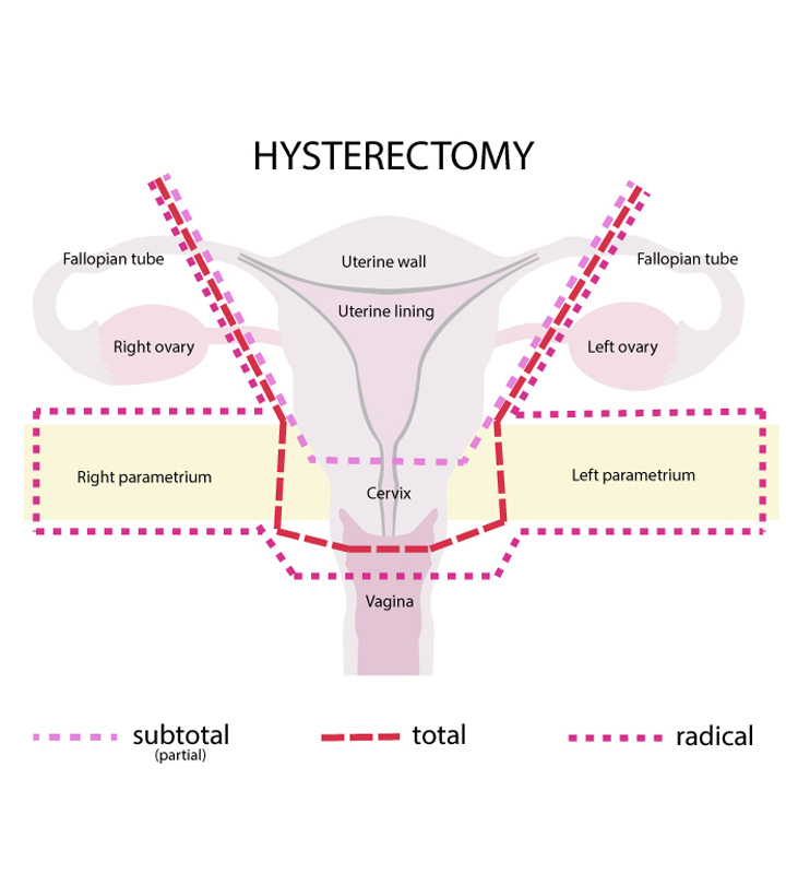 Orgasm after total hysterectomy