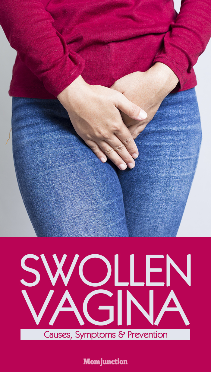 Swollen Vagina When Pregnant 50