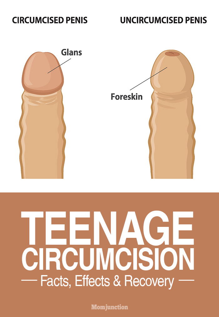 Difference Between A Circumcised And Uncircumcised Penis 95