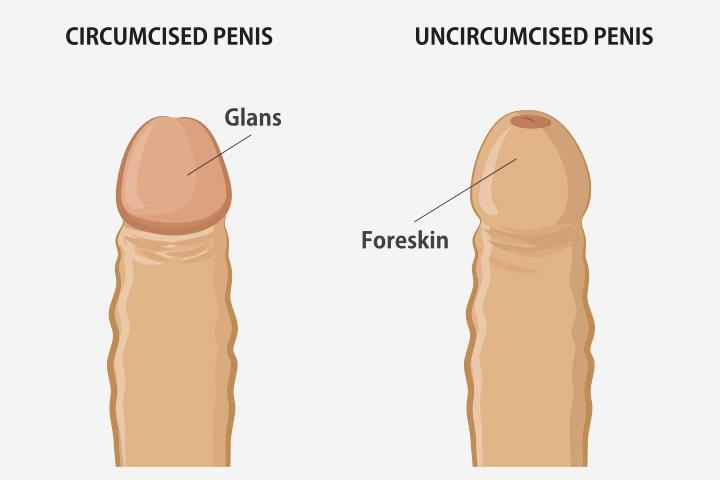 Circumsized Cock Images