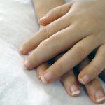 Arthritis In Children
