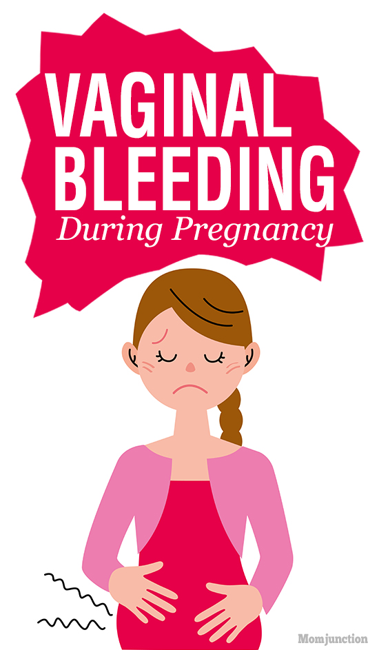 How To Stop Vaginal Bleeding Or Spotting During Pregnancy