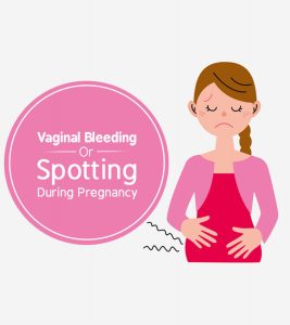 Bleeding When Pregnant: Causes, Diagnosis And Prevention