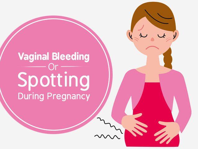 Pregnancy Spotting: What Is Normal And When To See A Doctor