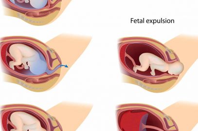 3 Vital Stages Of Labor: What Happens In Them And What To Do