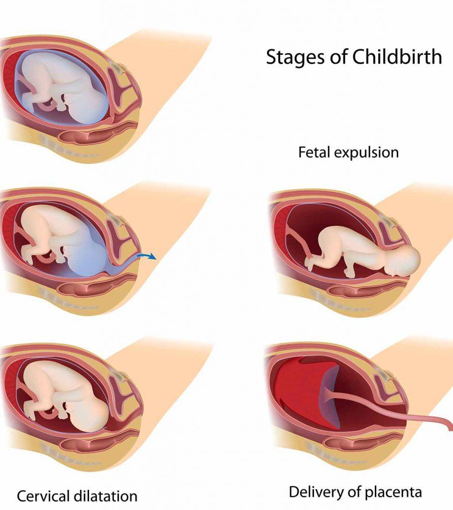 3 Vital Stages Of Labor: What Happens In Them And What To Do