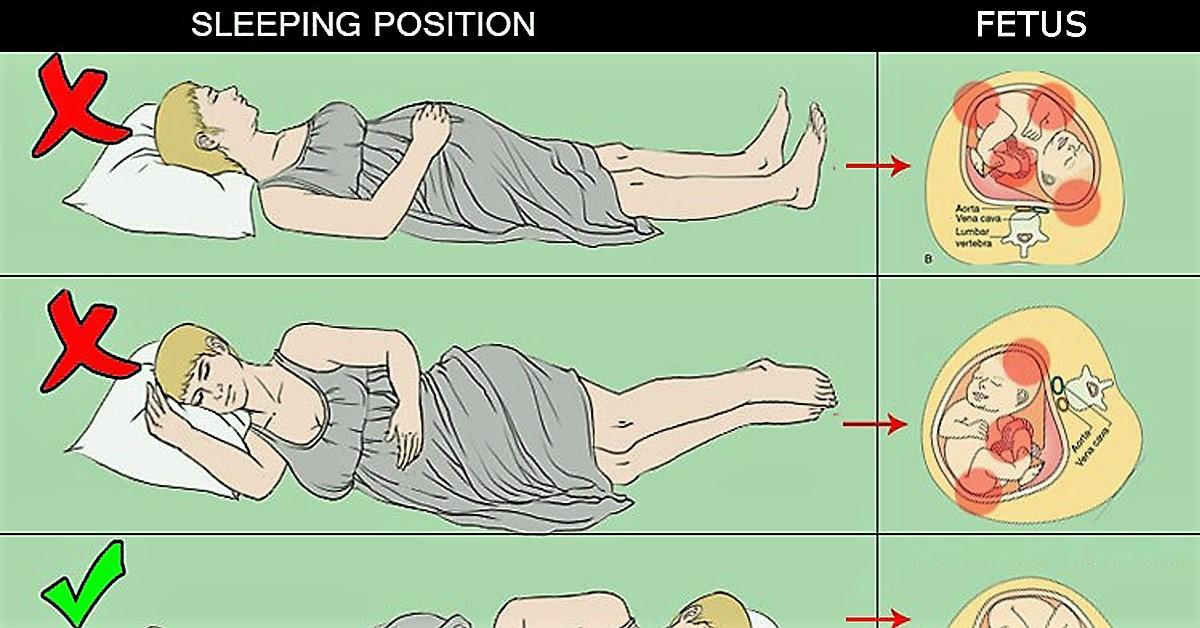 Pregnancy and sleep position