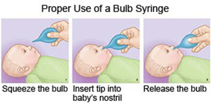 bulb syringe for baby throat