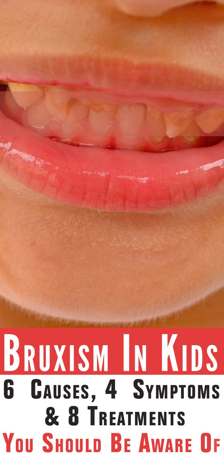 Bruxism In Kids Causes, Symptoms And Treatment