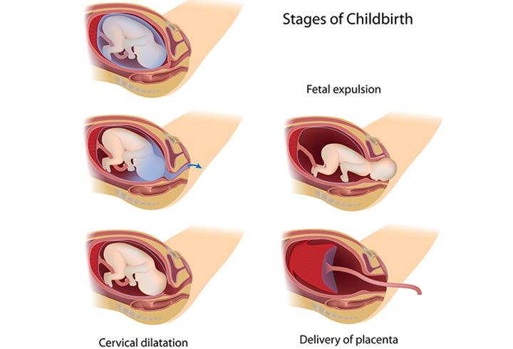 Phases Of Labor Chart