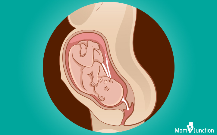 Umbilical cord presentation in baby birth position