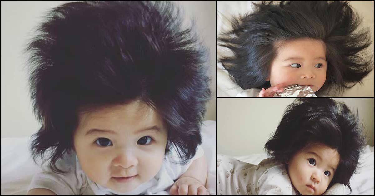 42 Top Photos 3 Month Old Baby Hair Falling Out - Baby Hair Loss What To Do If Your Baby Starts To Lose Their Hair Mustela Usa