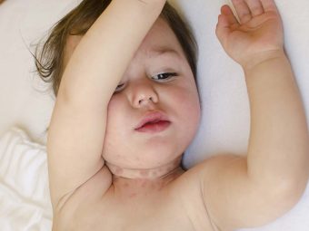 Baby Neck Rash Causes, Symptoms And Remedies