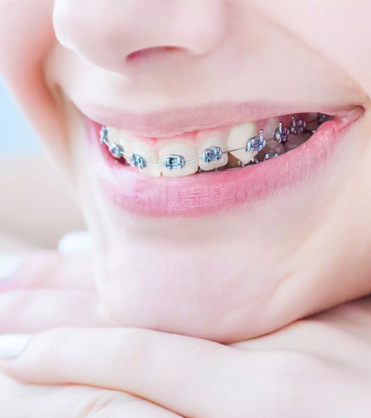 Braces For Kids: Right Age To Get Them And Dental Care To Take_image