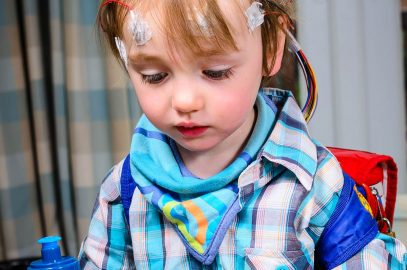 Epilepsy In Children: Causes, Symptoms And Treatment