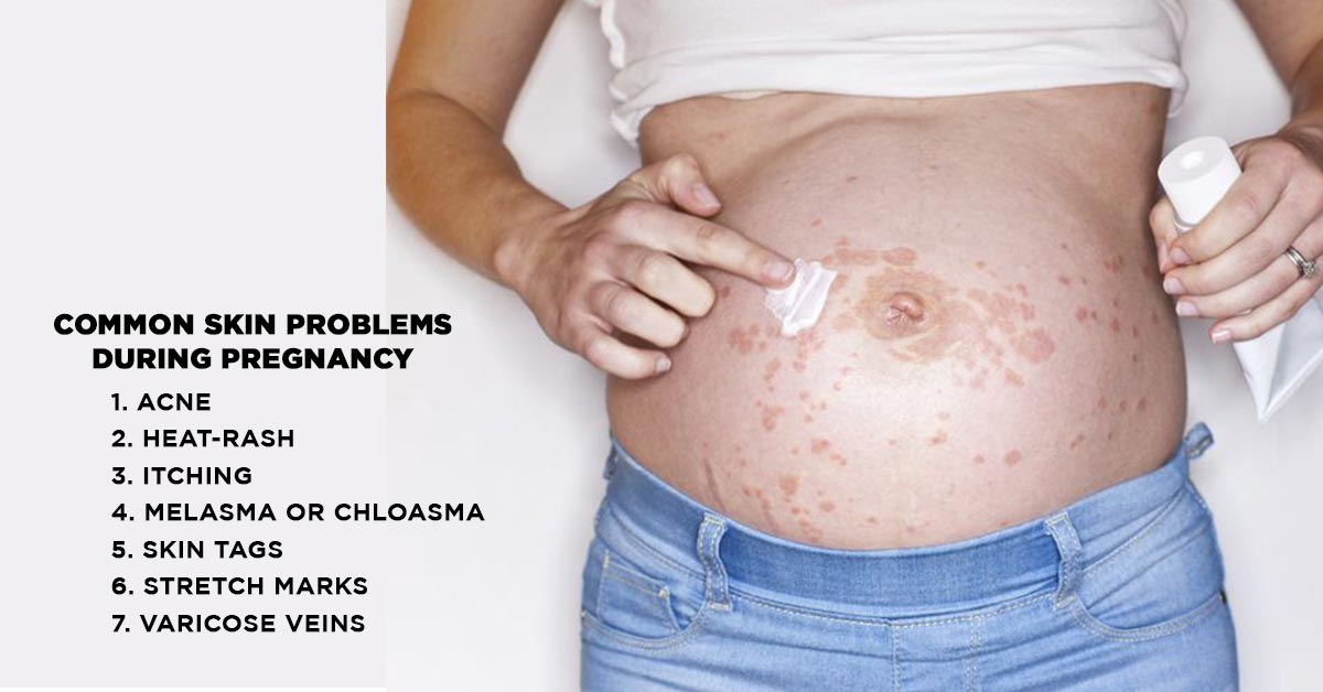 skin problems after pregnancy