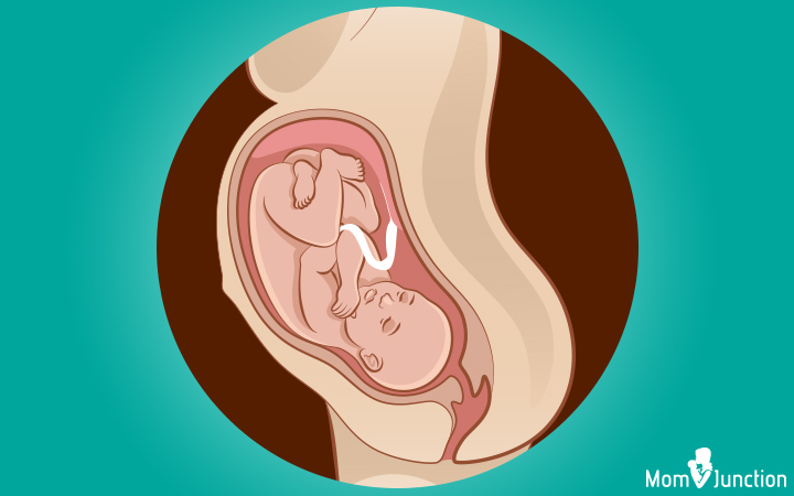 Occiput anterior (OA) baby birth position