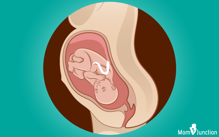 Occiput posterior (OP) baby birth position