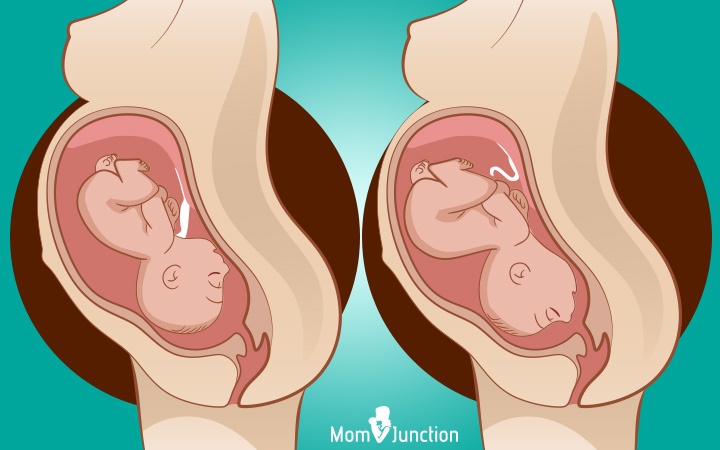 Occiput transverse (OT) baby birth positions