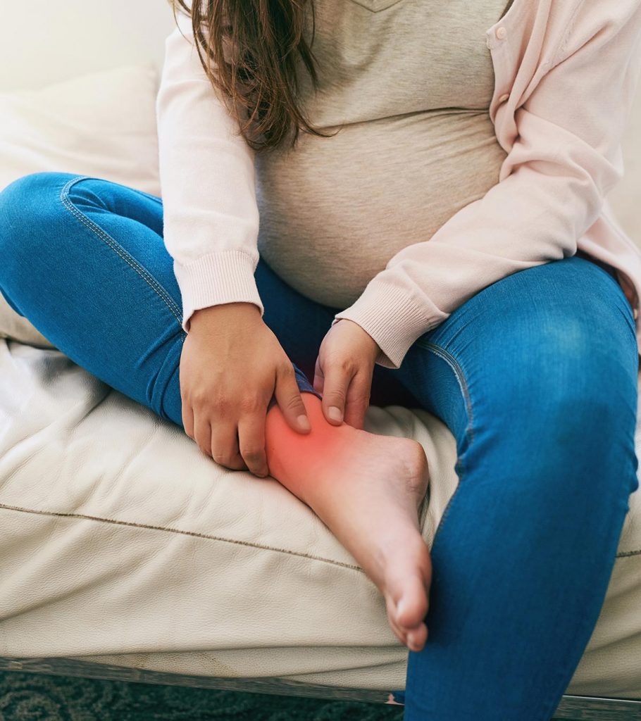 Swelling During Pregnancy Why It Is Caused And How You Can Get Relief