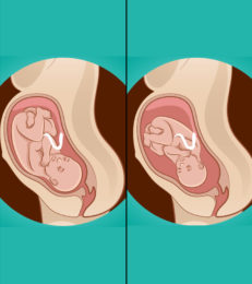 What Are Best Baby Birth Positions For Comfortable Delivery?