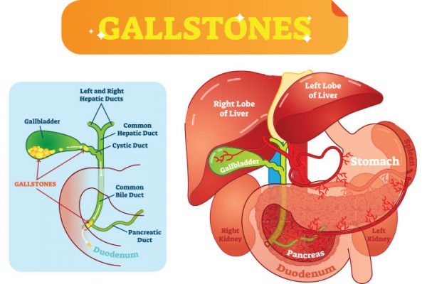 Gallbladder Pain In Pregnancy: Causes, Symptoms & Treatment