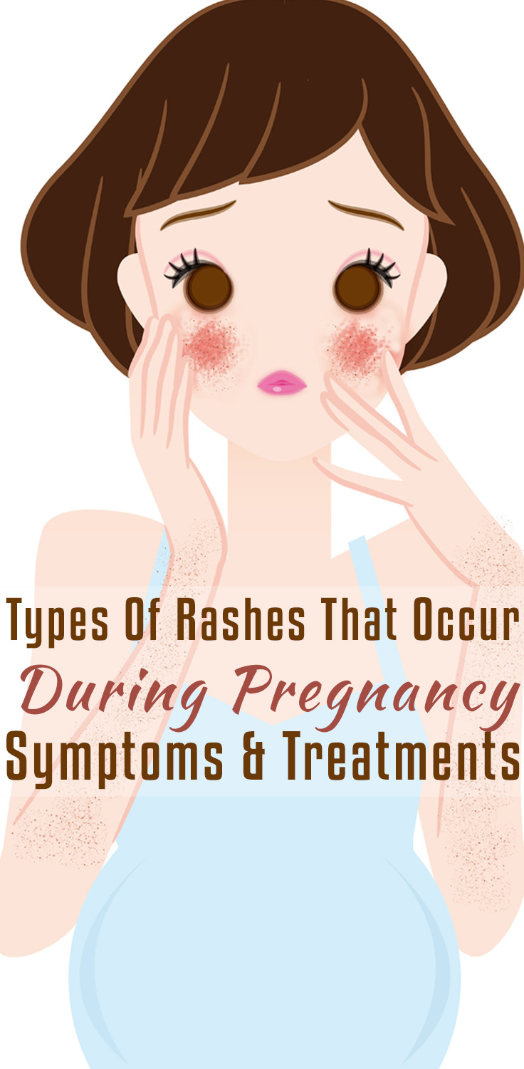 What Causes Skin Rashes During Pregnancy-8699