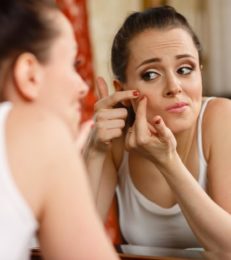 Causes Of Teenage Acne And Simple Home Remedies To Try