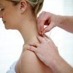 A pregnant lady getting acupuncture treatment