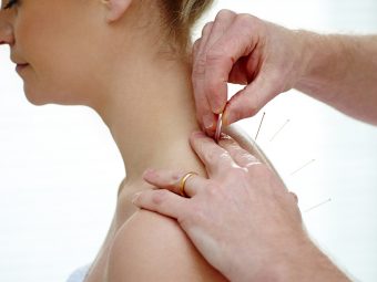 Acupuncture During Pregnancy: Is It Safe? Benefits And Risk