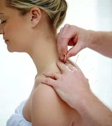 Acupuncture During Pregnancy1