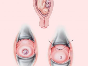 Cervix During Pregnancy: Causes, Symptoms And Treatment