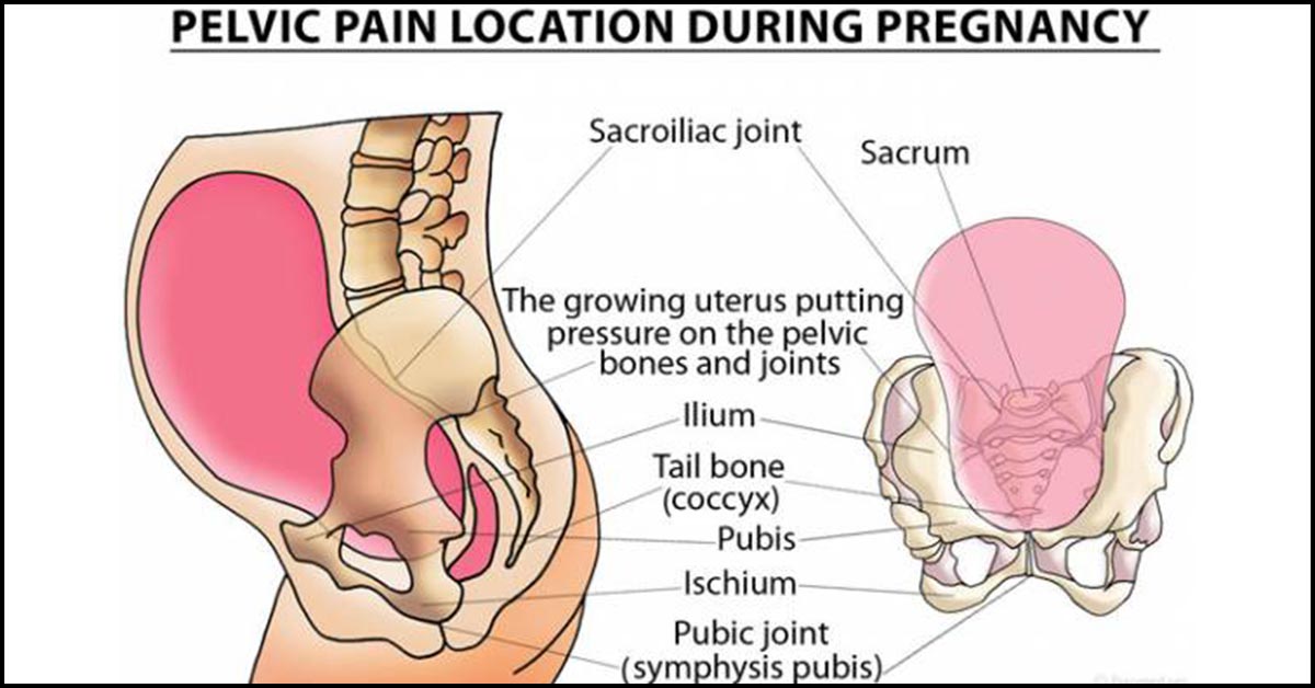 How To Soothe Pelvic Girdle Pain In Pregnancy