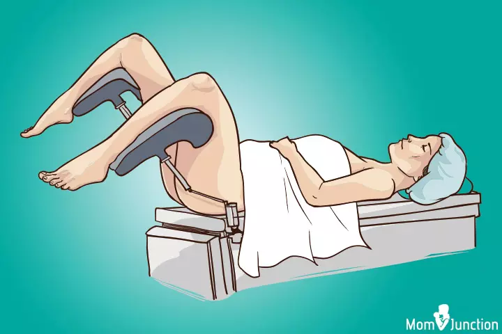 The lithotomy position, best positions during labor