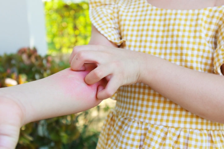 Skin allergies may lead to intense itching and redness