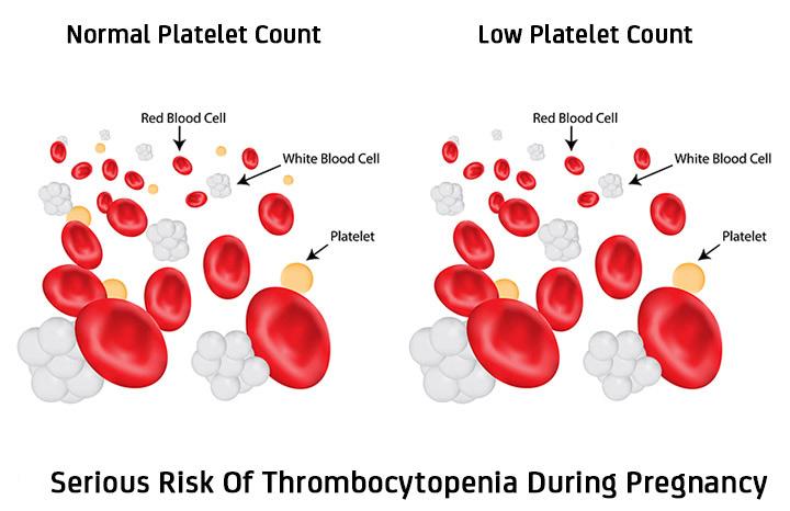 Diet Chart For Low Platelet Count