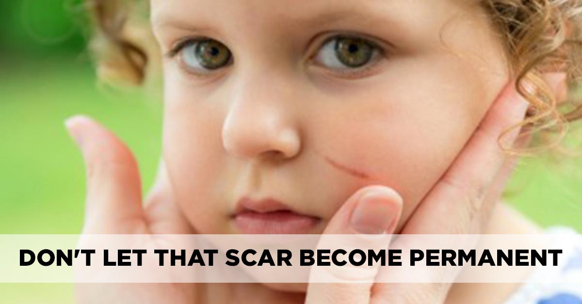 8 Simple Ways To Treat Kids Scars And Prevention Tips