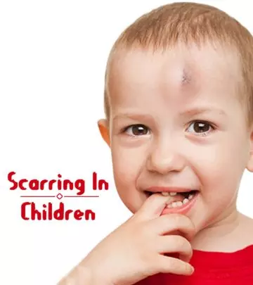 Ways To Treat Scars In Children